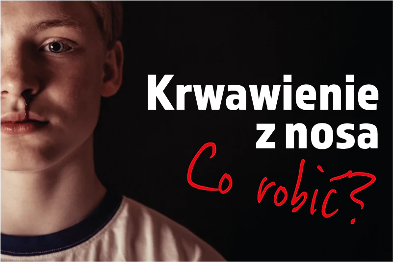 Krwawienie z&nbsp;nosa – co&nbsp;robić?